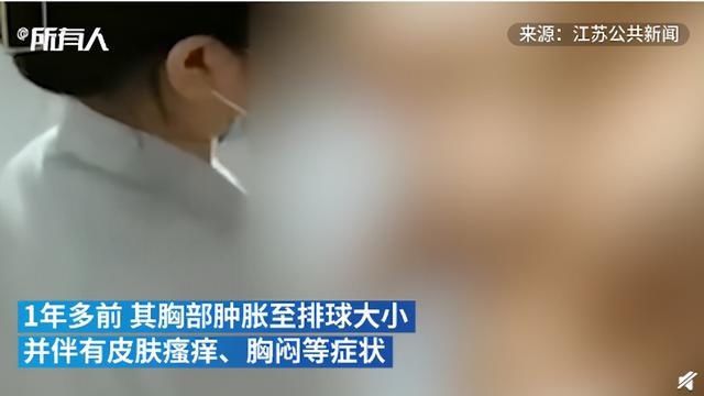 资质|女子隆胸20年后，两侧乳房取出4千毫升酱油色液体，医生提醒