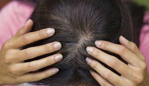 白头发拔1根长10根?3个“狠角色”,白发、脱发全拿下,显年轻