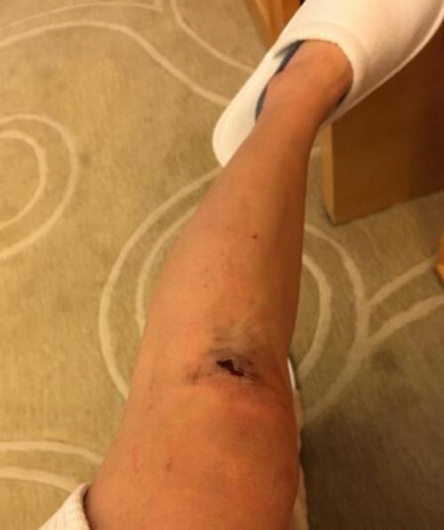 饮食|为什么老年人总是喊膝盖疼饮食牢记“2吃2不吃”,延长膝盖寿命