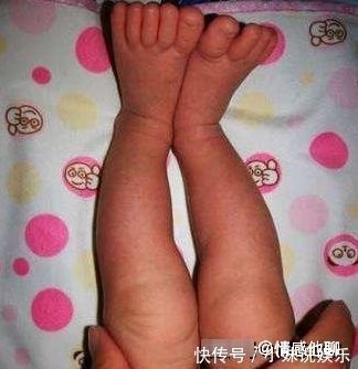 特征|孩子如果有这3个特征,将来多半是大高个,你家孩子中了几个?