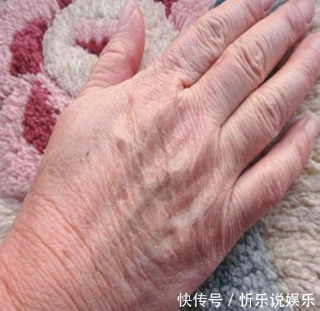 天气一冷手就变得皱巴巴的教你一个土方法,让双手变的嫩又滑!
