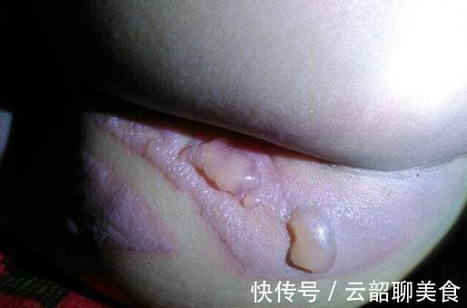 张病危|宝宝对不起!一个让全家人悔恨一辈子的日子!