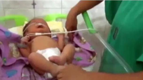 手机|孩子出生后没有鼻子,却拥有两根触角般的“须子”,妈妈悔不当初