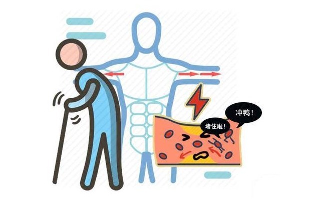 饮水量|保养血管，预防血栓究竟怎么做？医生告知：做好3点成功一大半