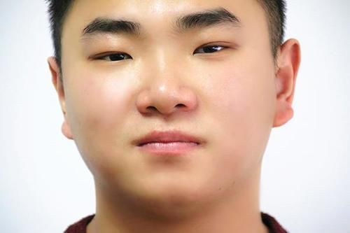 油脂|鼻子两边经常挤出的“白色长条”,是什么东西?教你告别草莓鼻