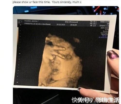 胎动|胎儿性格隔着肚皮能看出来吗?孕期欢脱的胎儿,出生后也多调皮