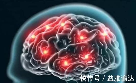 血管堵塞|脑供血不足时，身体会出现4个表现，提醒你应该疏通血管了