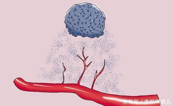高血压患者|高血压能不能喝茶?喝什么茶最好?有什么注意事项?一次性讲清