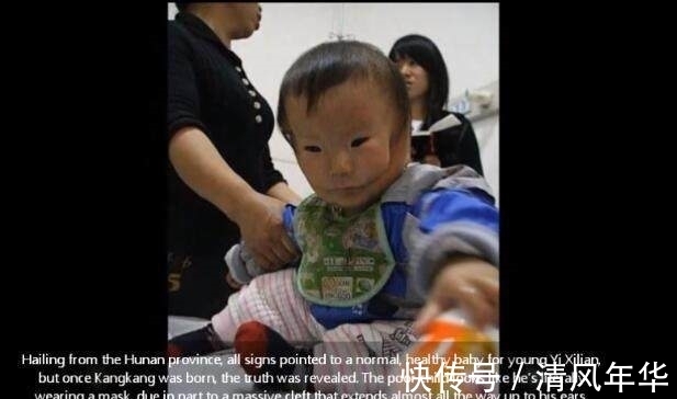 妈妈|宝宝安全出生,可妈妈看到宝宝的样子失声痛哭!