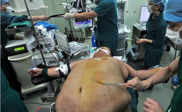 娶妻生子|570斤男子减肥一年后,邻居一眼都没认出来,如今娶妻生子