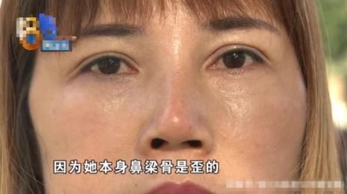 女子|女子接二连三做整容,做完“九度媚眼”之后,眼泪经常止不住往下流
