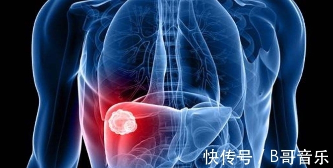 胡萝卜胡萝卜|肝不好的女人,3种食物是肝脏的“救星”,远离肝癌、肝硬化