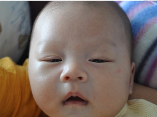 宝宝|如果宝宝脸上有这3种现象,说明宝宝脾胃有问题,别不在意
