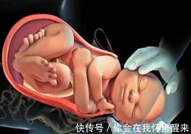 宫颈|顺产提及的“宫口十指”到底是啥概念?得知真相后,心疼顺产妈妈