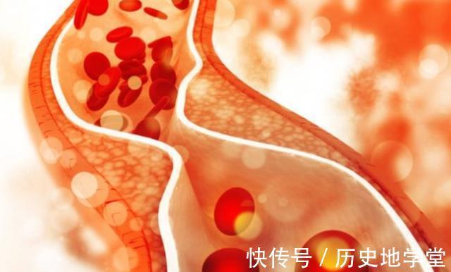 身体|经常吃豆腐乳,对身体好还是不好?爱吃豆腐乳的人,不妨了解下