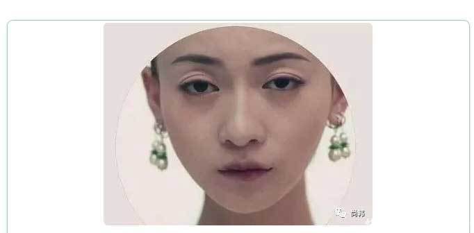 恢复|为啥割了双眼皮以后,你恢复的比别人慢