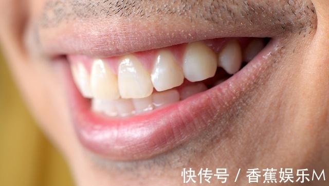 脸部|男性步入“衰老期”，脸部会有5个变化，一个不占，说明你还年轻