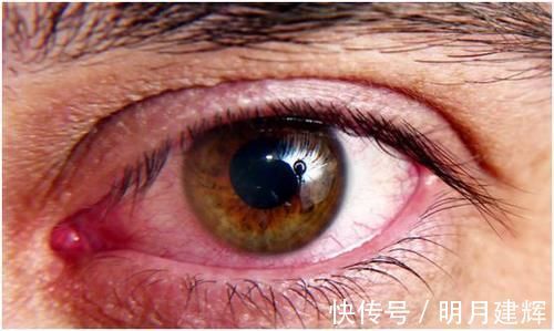 肝脏|提醒:肝不好的人,尽量别碰这两种蔬菜,可能会伤肝,别不当回事