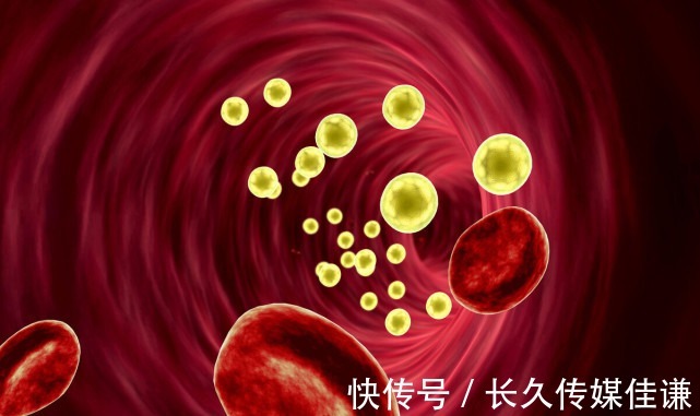 高血脂|血脂高的人要远离豆腐吗？除了豆腐，3种素食建议少吃一点