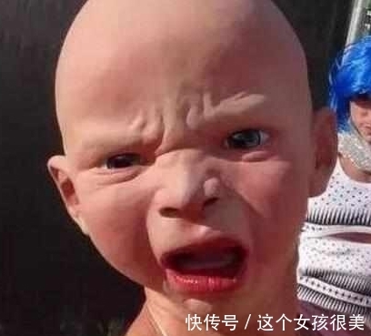 基因变异|一家三口相貌变成巨婴,是基因变异还是逆龄生长,原来是这个原因