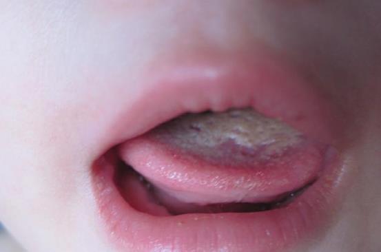 脾胃|吃一次半个月才能代谢干净,家长却在纵容,医生:盲目毁了孩子