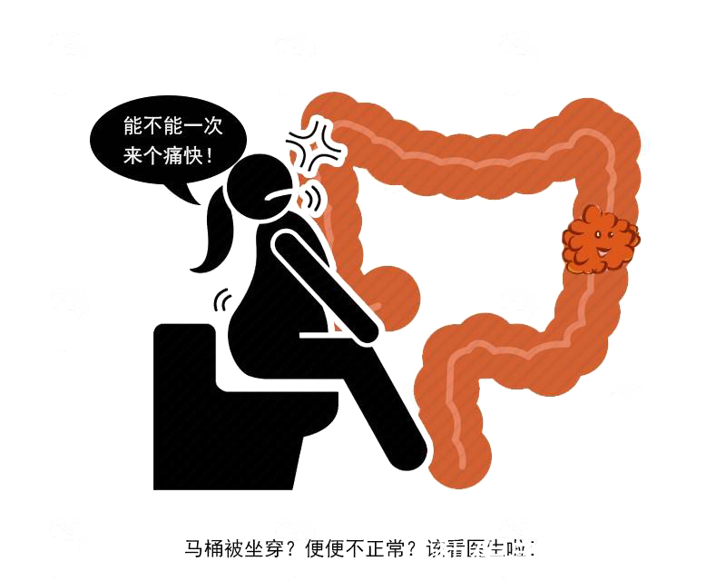 排便困难|当肠癌来报道时,排便或有4种变化,若你有,趁早进行肠道检查
