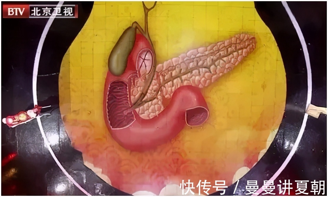 急性|这些炎症可能比癌症更可怕,发病快、致死率高