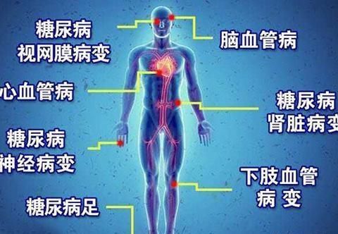  脉粥样硬化|糖尿病人的血糖一定要控制在正常范围内吗？如果偏高一点会咋样？