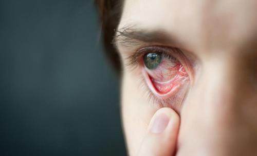 眼部|眼睛总是疼痛是怎么回事？引起眼睛痛的5种眼病要警惕