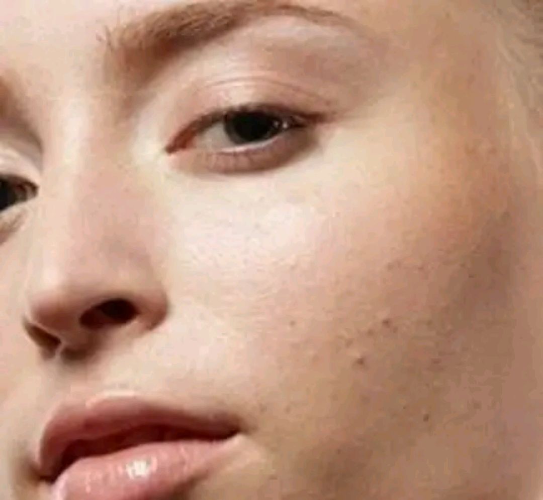 鼻子上挤出的像白色芝麻大小的颗粒是什么又该怎样帮助去除呢