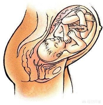 胎儿|怀孕八个月,彩超医生说孩子腿长,这是什么意思?
