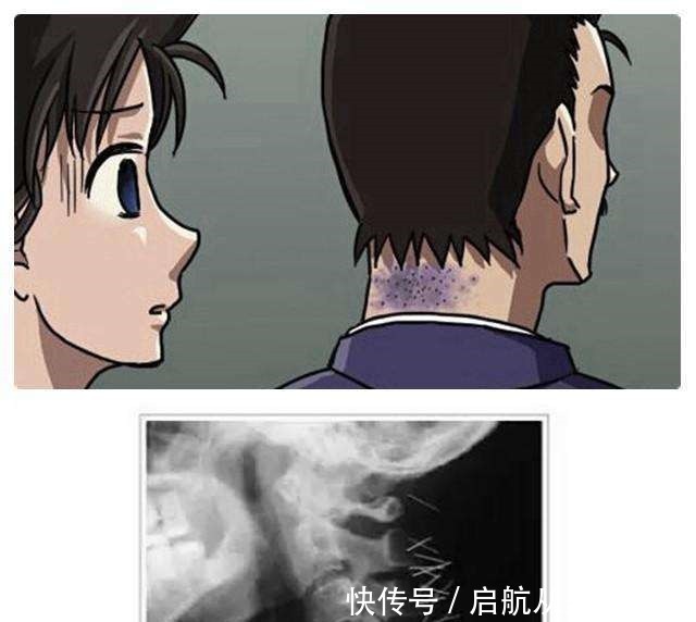 侦探|《名侦探柯南》之十大未解之谜,我比较关心毛利小五郎的脖子