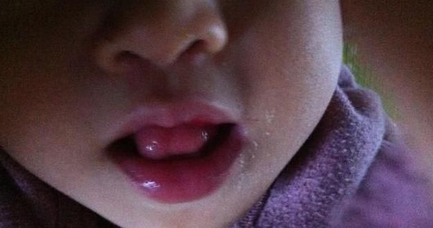 零食|女童舌头被“炸成筛子”,一元一包的“新奇零食”才是真“垃圾”