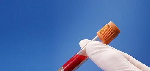 降血脂|高血脂有这几个“克星”, 坚持吃, 清血管垃圾, 轻松降血脂