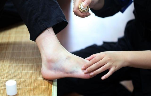 脚扭伤越来越肿但不痛