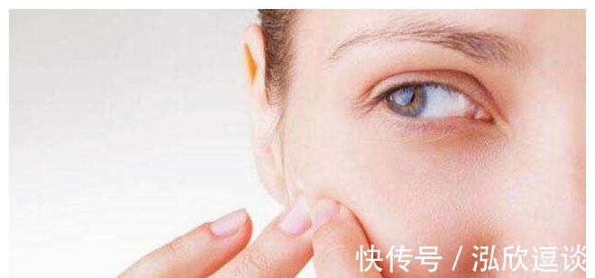 伤口|将痘痘挤破了之后,该怎么处理才不会留疤?可别做错了