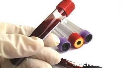 运动|高血压患者走路锻炼，走六千步与一万步的效果差别？一起了解下