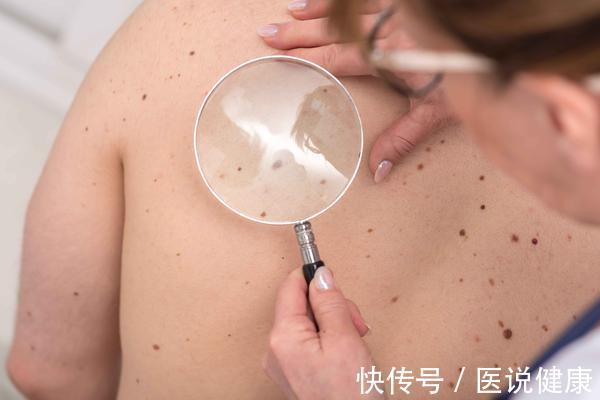 饮酒|喝酒后,身体有这5种情况,或是肝脏在向你球了,要及时戒酒