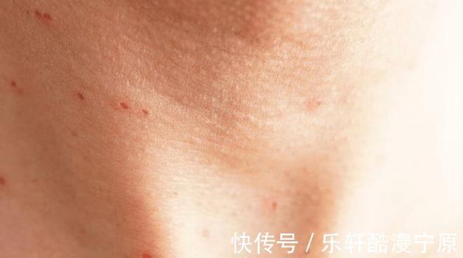 下身|女人身体2处“发痒”,注意是HPV来了,保护宫颈牢记这3点