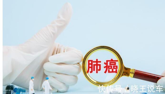 靶向|晚期肺癌,不治疗的患者能活多久?治疗后又能获得哪些好处?