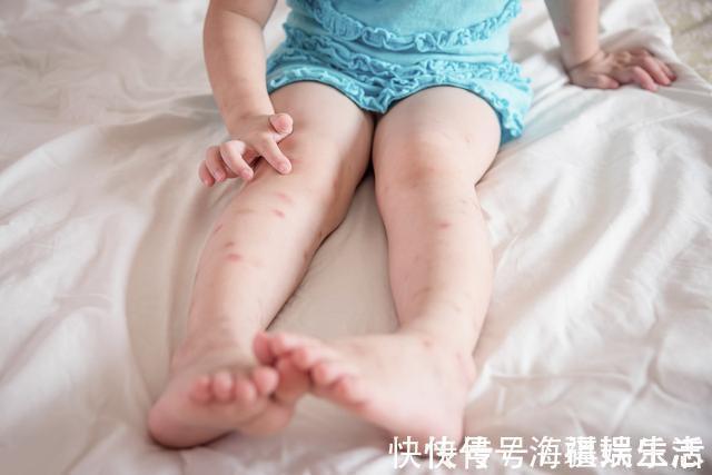 驱蚊脂|睡觉蚊子耳边叫,开了灯却找不到教你一笨招,孩子一夏天不被咬