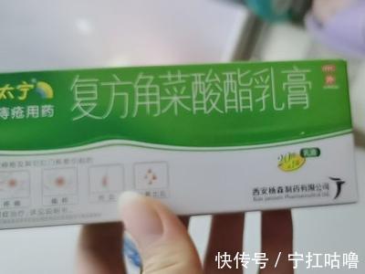 肛肠科|肛肠科实习生透露的痔疮药分享!终于知道医生痔疮好这么快的原因了!