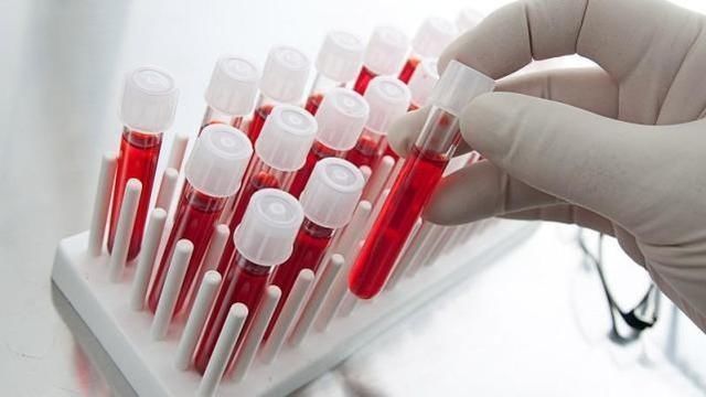  癌症|癌症的发生和血型有关O型血最长寿、B型血易患癌告诉你事实