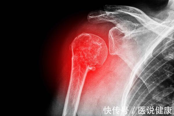 肾脏功能|肾健康的9个标准,若都符合,表明肾脏功能还不错,别盲目补肾