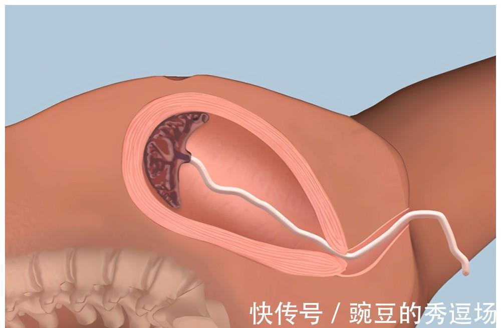 下体|分娩结束后,男医生又把手伸进产妇肚子里,别着急骂人是为了你好