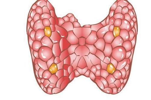 甲状腺结节|甲状腺出现结节不要怕，记住5吃3不吃，结节或许会慢慢变小！