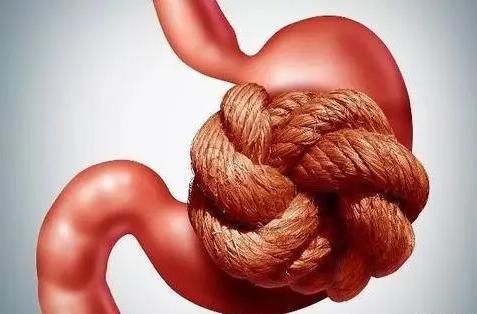 鸡内金|大蒜是胃病的“发物”？消化科医生：若想养好胃，“3物”要少碰