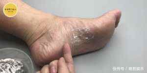 阿司匹林加牙膏,作用好厉害,解决了好多人一大困扰,告知家里人