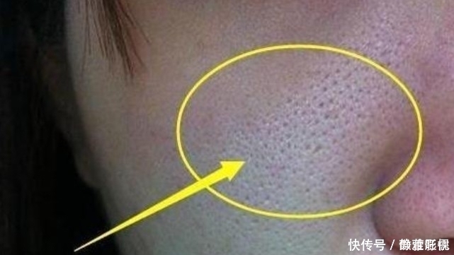 护肤|好皮肤是养出来的，记住这个护肤小技巧，不怕没有好皮肤