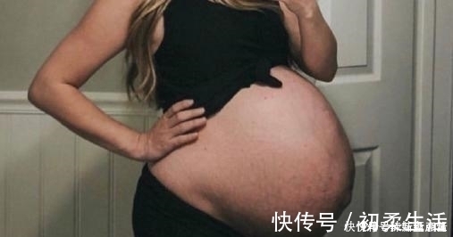 分娩|预产期到了,怎么让宝宝“尽快发动”?试试这几个“催生妙招”